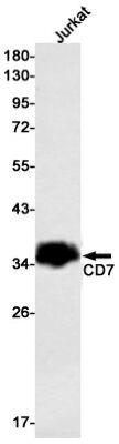 TD-R23856-WB-2.jpg