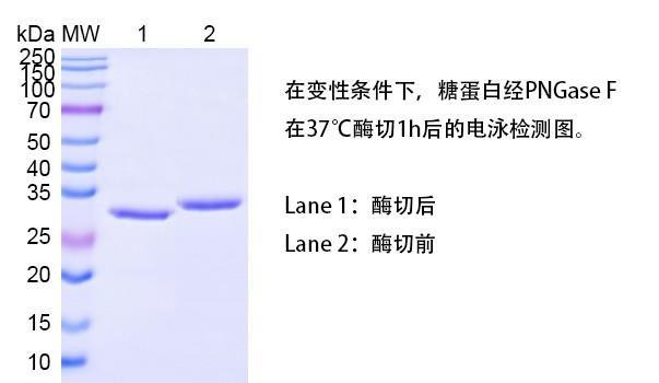 CSE00005-PNGase F.png